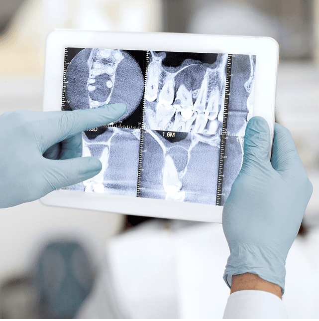 Digital dental xray.png
