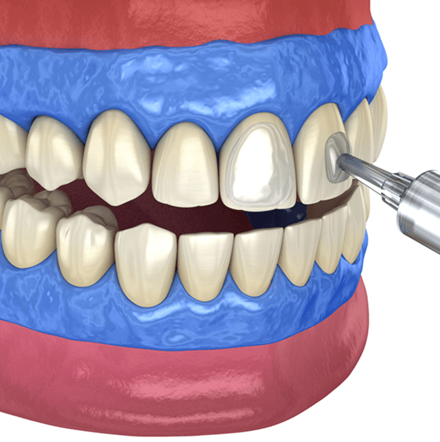 cosmetic-dentistry2.png