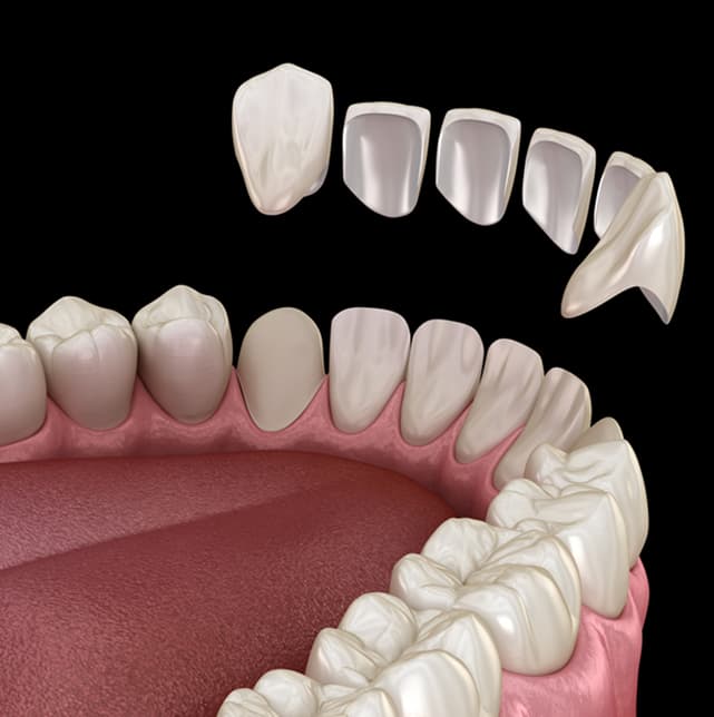 cosmetic-functional-full-mouth-reconstruction.jpg